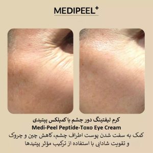 کرم دور چشم ضد چروک پپتاید توکس مدی پیل MEDI-PEEL Peptide-Tox Bor Eye Cream