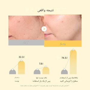 ماسک ورقه ای روشن کننده کوجیک اسید و زردچوبه مدی کیوب Medicube Kojic Acid Turmeric Brightening Gel Mask
