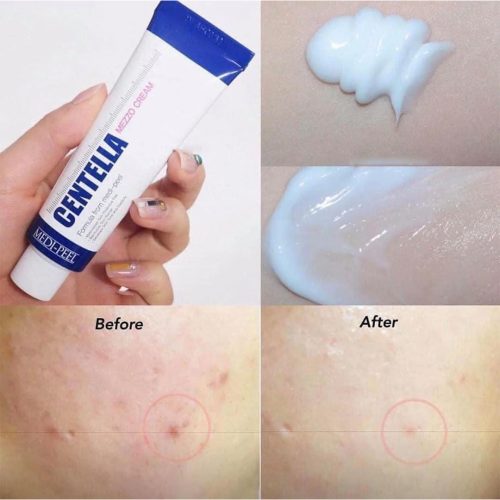 مزو کرم تسکین دهنده و ترمیم کننده سنتلا مدی پیل Medi-Peel Centella Mezzo Cream