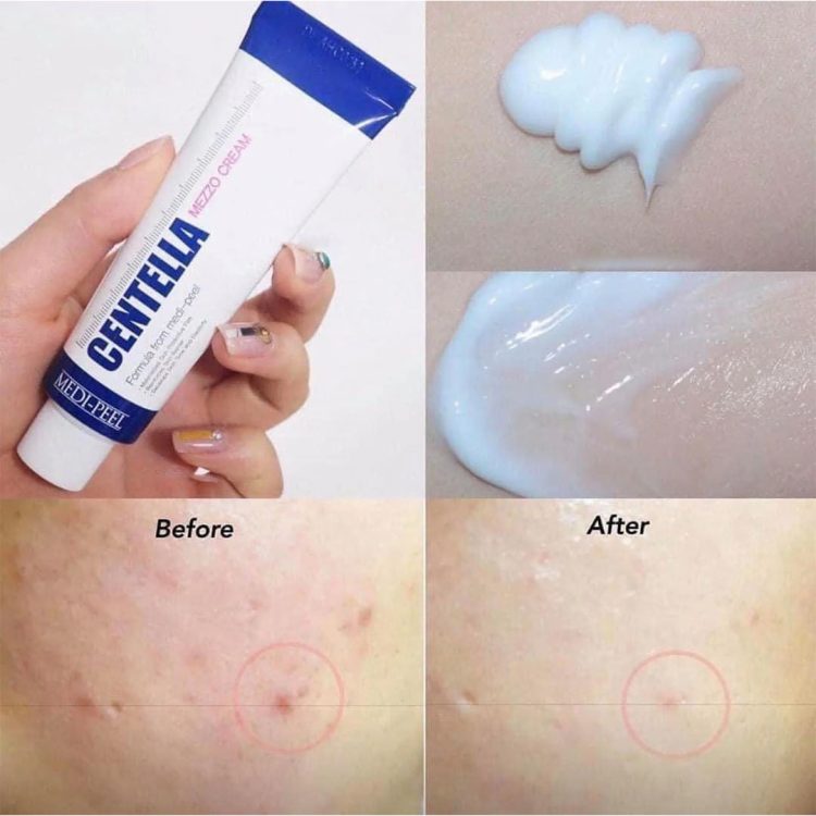 مزو کرم تسکین دهنده و ترمیم کننده سنتلا مدی پیل Medi-Peel Centella Mezzo Cream